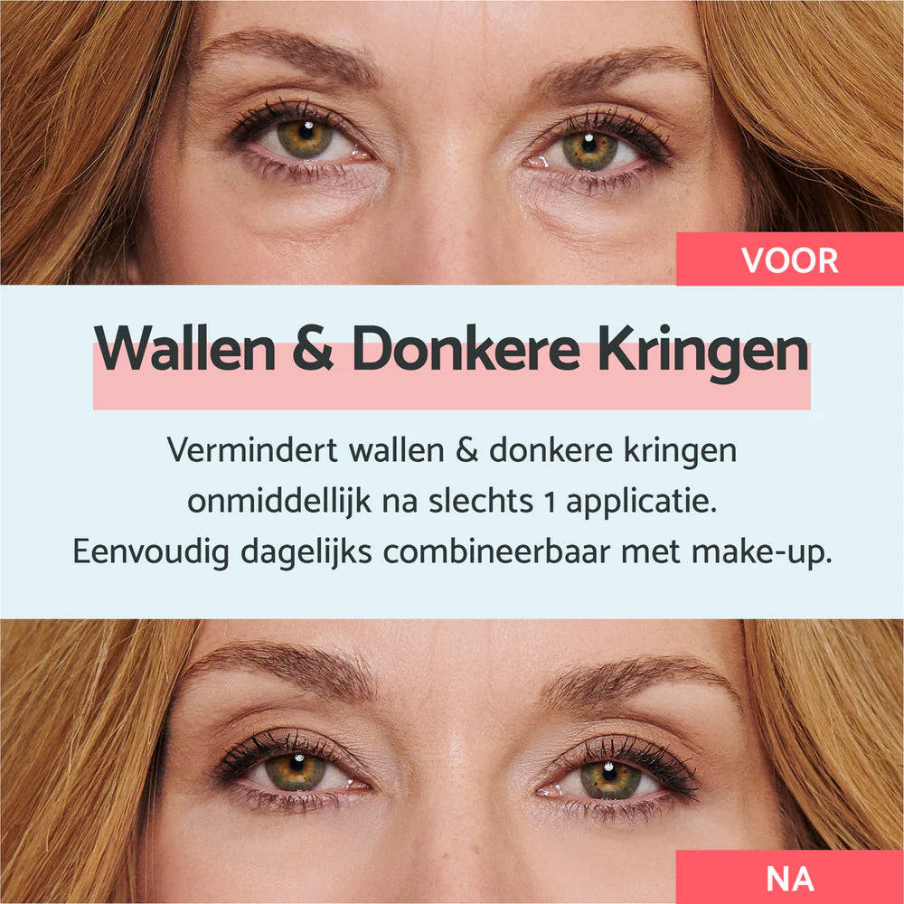 Remescar Wallen en donkere kringen (1 Stuks)