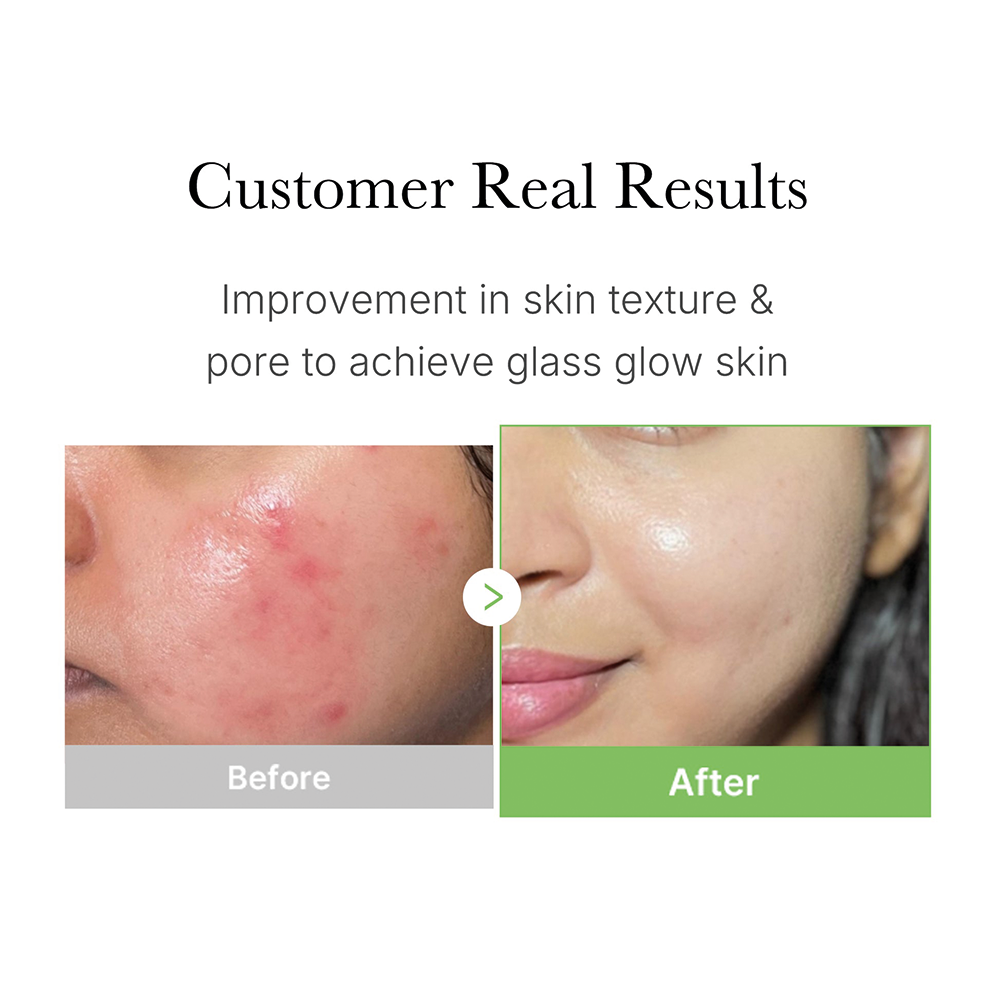 MediCube Exosome Cica Calming Pad MediCube