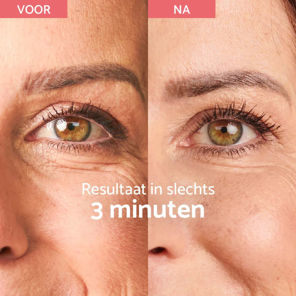 Remescar Instant Rimpel Corrector (8 ML) - Parfumvrij