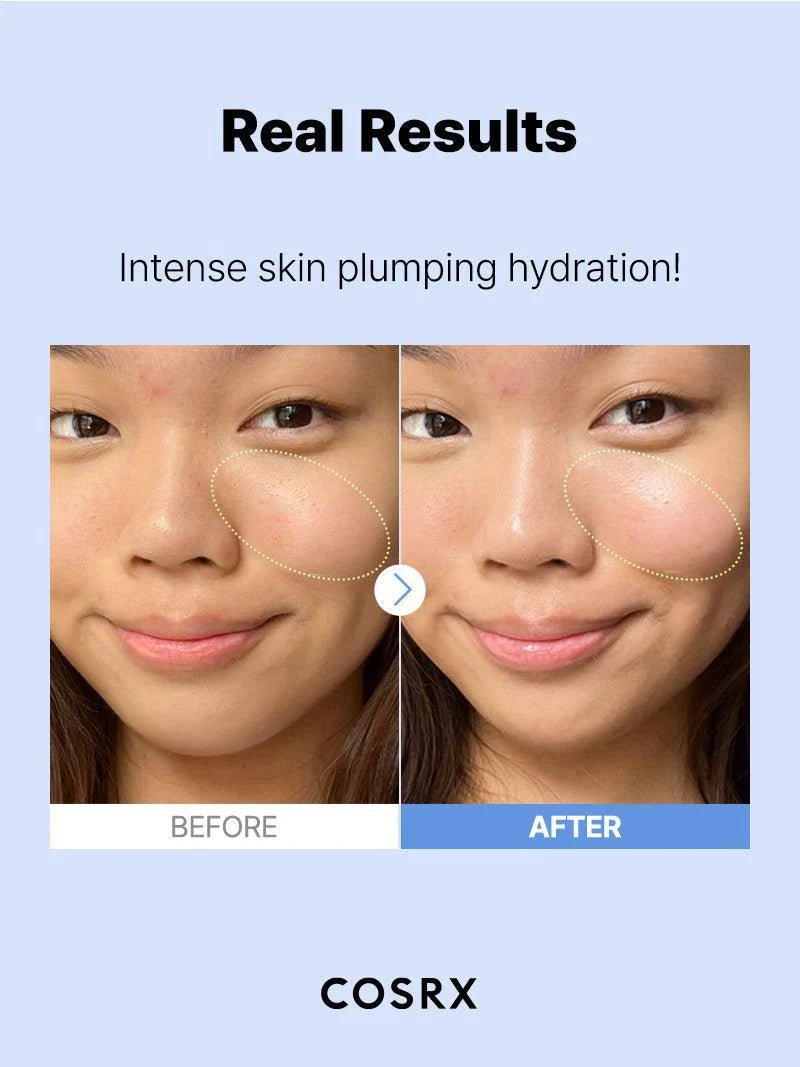COSRX The Hyaluronic Acid 3 Serum (20 ML) COSRX